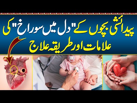 Bechon K Dil Mein Surakh Ka ilaj - Heart Hole in Child - Congenital Heart Disease Causes & Treatment
