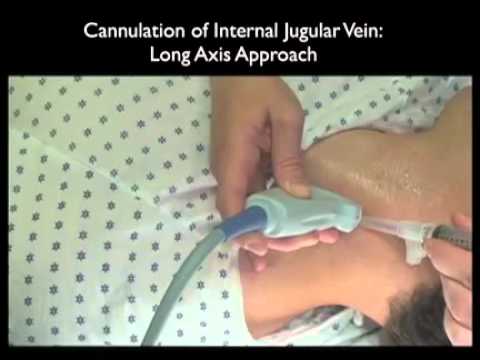 How to: Ultrasound Guidance for Central Venous Access Case Study Part 2