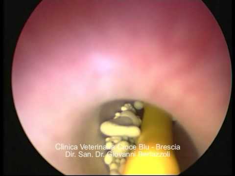 Trattamento laser della prostatite Quali sono le dimensioni di una prostata normale