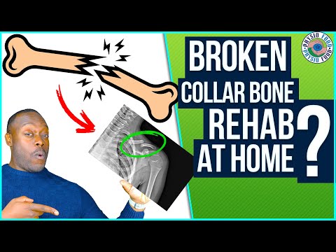 How to Rehab a Fractured Collar Bone?