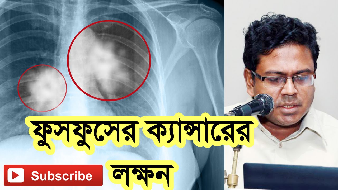 ফুসফুসের ক্যান্সারের লক্ষন। Symptoms of Lung Cancer.