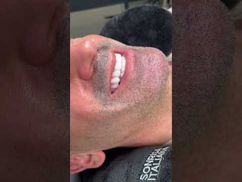 THEY BUTCHERED ME!!!!