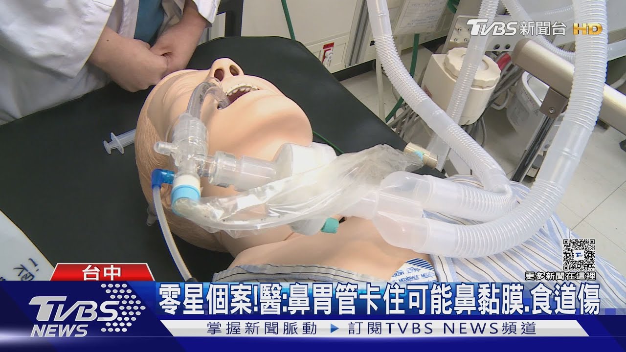 「鼻胃管肚中打結」 60歲女上腹痛急找醫