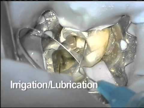 ProTaper Universal Access & Shaping | Dentsply Sirona