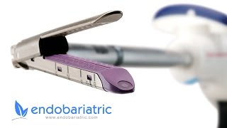 Gastric Sleeve: Staples and The Newest Technology | Dr Alvarez from Endobariatric