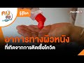 อาการ
