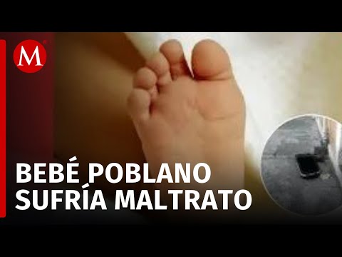 Bebé encontrado en una maleta en Puebla presenta síndrome de niño maltratado