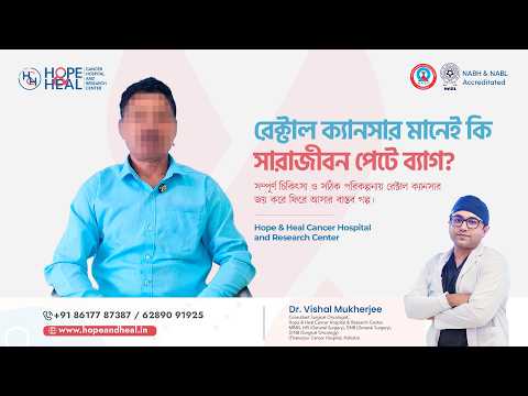Overcoming Stage 3 Rectal Cancer: Patient Recovery Story | Dr. Vishal Mukherjee