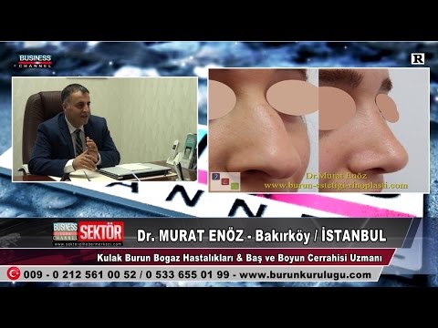 Dr.Murat Enöz - KBB Uzmanı - Burun Estetiği - Burun Ucu Estetiği - Burun Ucu Kaldırma