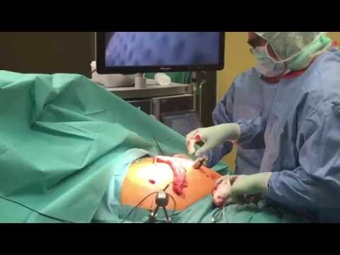 Prostanorm fallen ihr Getränk Finasterid auf einem Kurs von Steroiden und Prostata