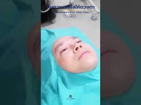 คืนความสดใสให้ดวงตา ✨ Sub Brow Lift