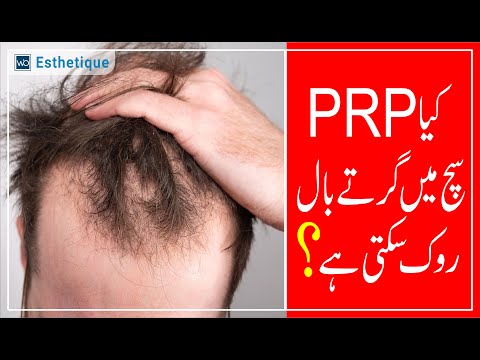 Can You Regain Your Hair Through PRP? PRP Treatment Explained