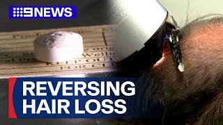 Download lagu Volunteers wanted for hair-loss transformation clinical trial | 9 News Australia mp3