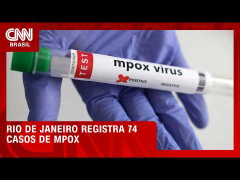 Rio de Janeiro registra 74 casos de Mpox em dois meses | CNN AGORA