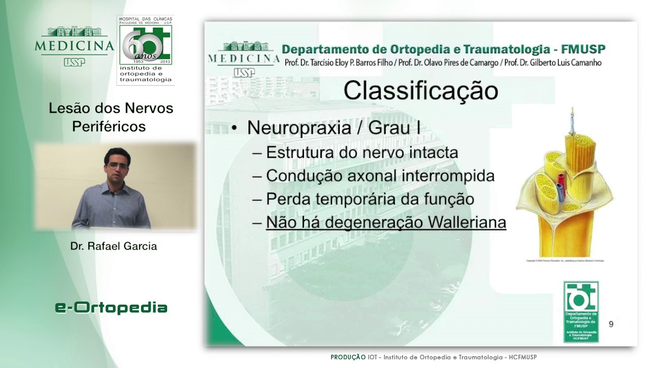 Lesão Nervos Periféricos  - Dr. Rafael Garcia