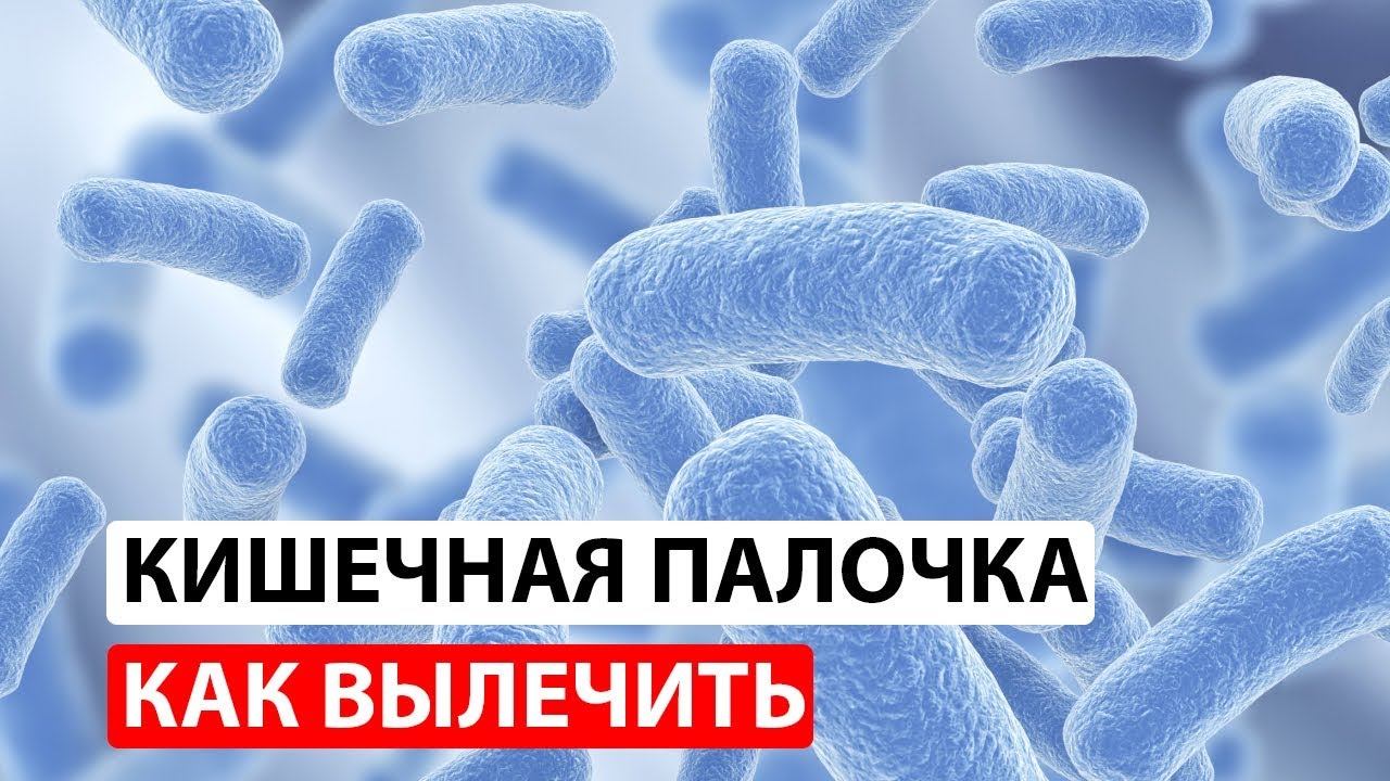 Кишечная палочка в анализах: лечение и профилактика