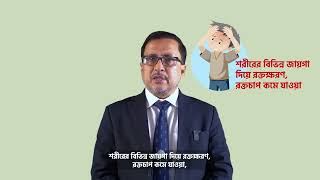 ডেঙ্গু লক্ষণ