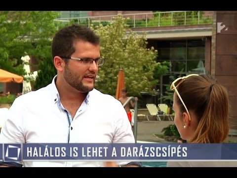 Darázscsípésre sem jó a kalcium: Kautzky Armand majdnem meghalt emiatt (dr. Novák  Hunor a TV2-ben)