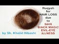 Ruqyah For HairLoss Due To SiHR MAGiC EViL EYE Or ILLNESS By Khalid Habashi