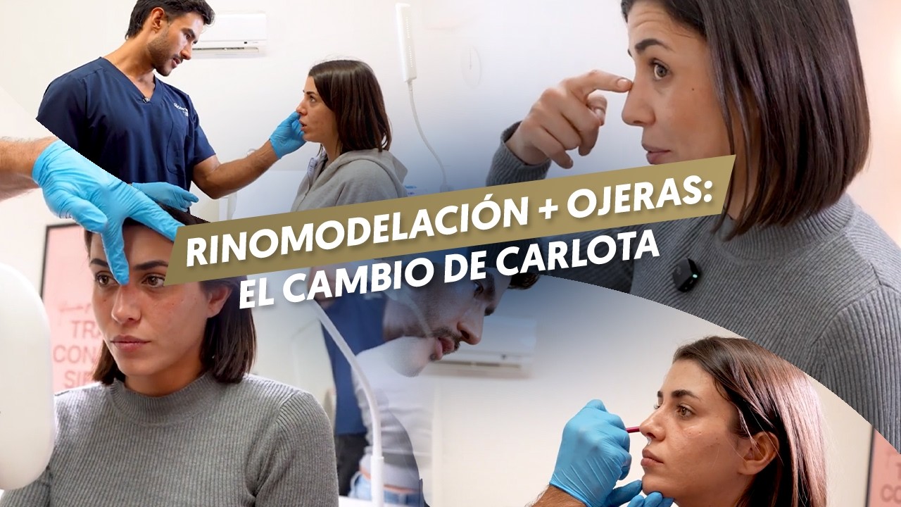 Cargar vídeo: 