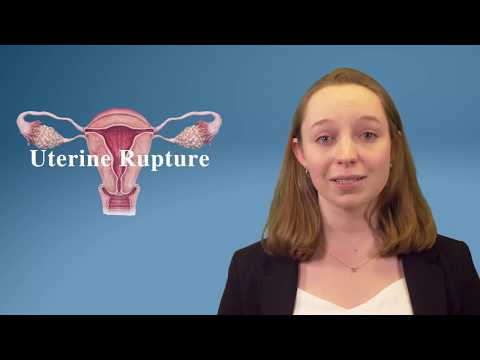 3 Most Dangerous Childbirth Complications