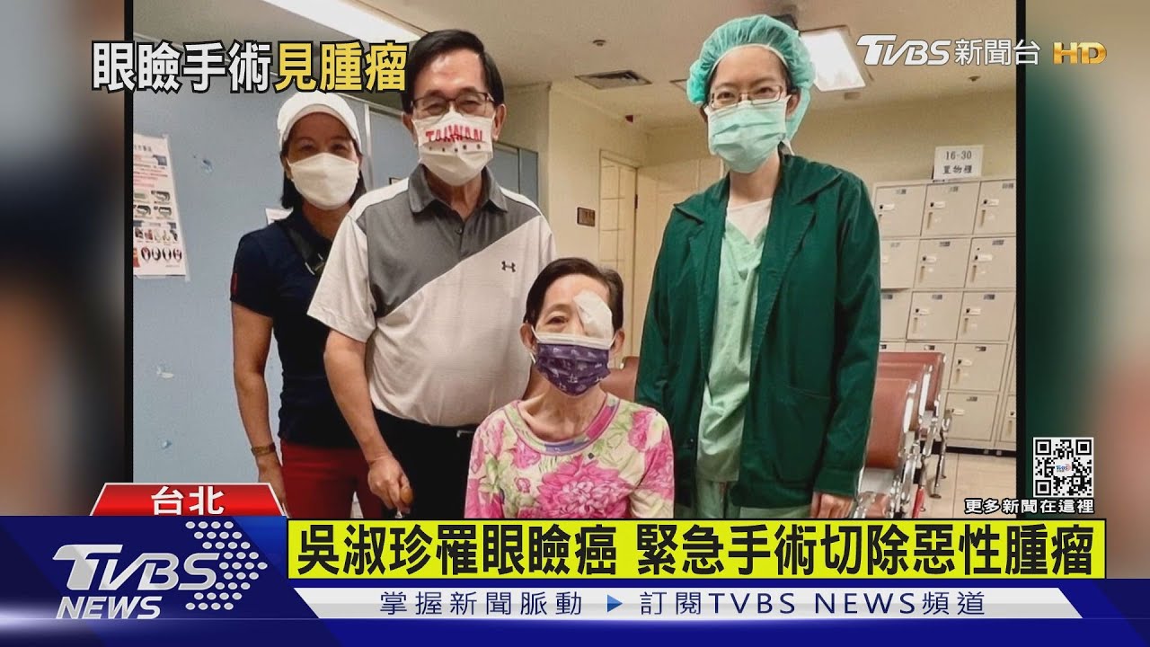吳淑珍罹眼瞼癌 緊急手術切除惡性腫瘤