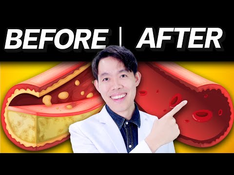 5 สุดยอด ผัก ล้างไขมันในเลือด