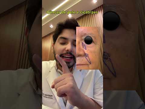 Mathias Gama De Aguiar Ferreira-8