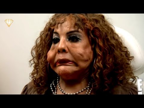 download lagu mp3 mp4 Plastic Surgery Disasters, download lagu Plastic Surgery Disasters gratis, unduh video klip Plastic Surgery Disasters