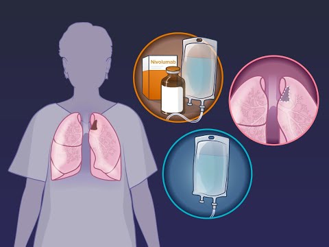 Nivolumab Opdyta 100 Mg Injection