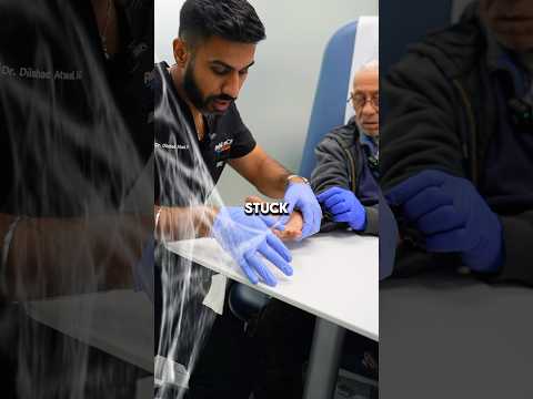 How do you unlock a trigger finger? #triggerfinger #painrelief