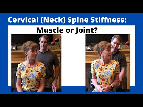 Positive Hoffman s Sign Hyperreflexia and Spurling s Test