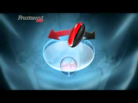 La dimensione della prostata in prostatite cronica Quanto vitaprost farmacie Stolichka
