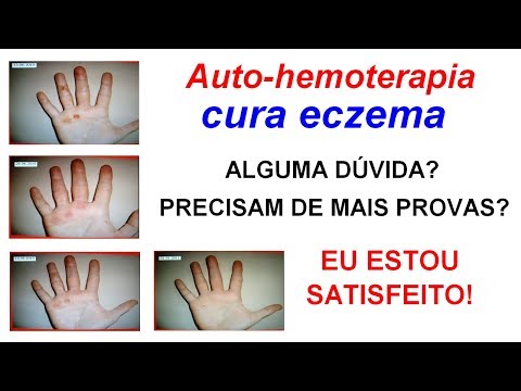 Comprar Barnaul akrustat Orações no momento de tratamento de psoríase