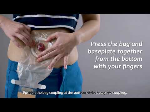 Coloplast Alterna 1-piece convex deep transparent bags 17471