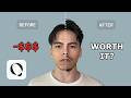 I Paid For The QOVES Looksmaxxing Facial Analysis So You Don T Have To