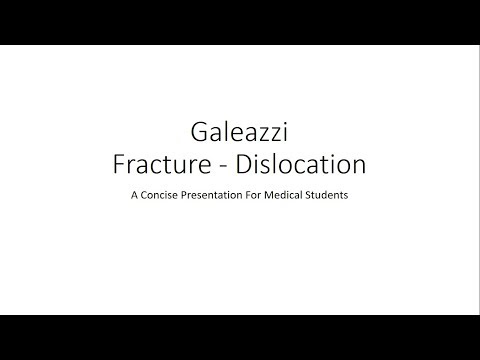 Galeazzi Fracture Dislocation - Orthopedics for Medical Students