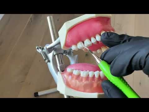 The Difference Between Adaption and Angulation with Dental Hygiene Instruments