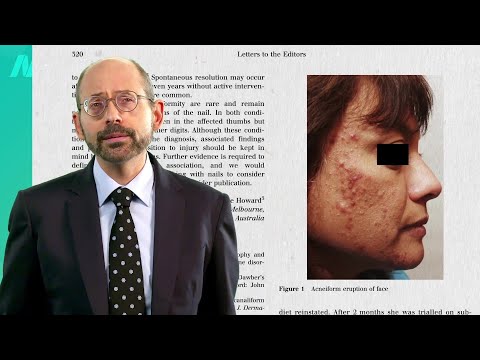 Do Vitamin B12 Supplements Cause Acne?