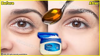 In 3 days Remove Under Eye Bags Completely | Remove Dark Circle, Wrinkles, Puffy Eyes