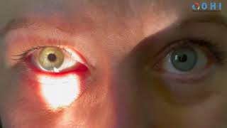 Swinging Flashlight Test