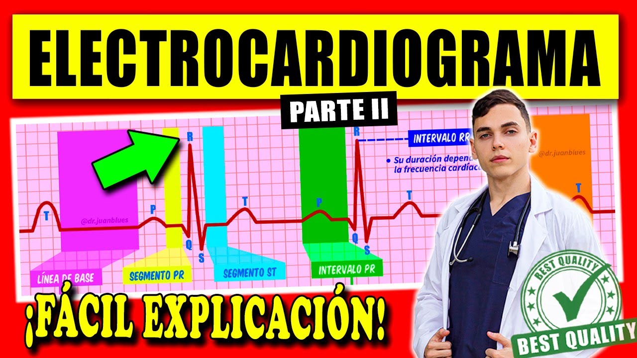 ELECTROCARDIOGRAMA Interpretación : FÁCIL EXPLICACIÓN
