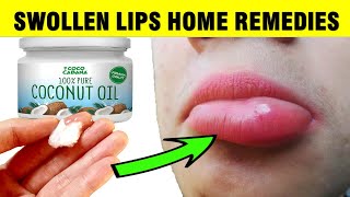 How To Treat SWOLLEN LIPS Naturally At Home