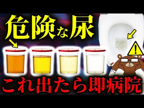 泡立ち.色.臭い..放置厳禁！絶対に知らないと後悔する「尿でわかる病気のサイン」の見分け方。「痛くないおしっこ」が逆に危険？「消えない泡」の正体とは。頻尿は何回から要注意？医師が完全解説！