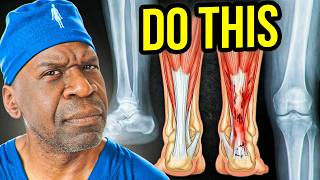 Why Your Achilles Tendons Hate You, And You Can't Get Rid Of Your Tendinitis | Surgeon Explains