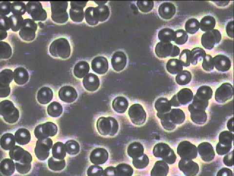 CCC0150091 @ 2015.10.29 before treatment