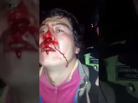 В багажнике автомобиля попавшего в ДТП обнаружен труп