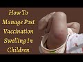 How To Manage Post Vaccination Swelling In Children Dr Pasunuti Sumanth