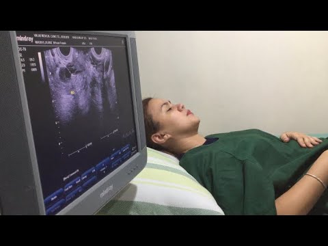 Magandang site para sa pagkawala timbang Mawalan ng Timbang tama ru