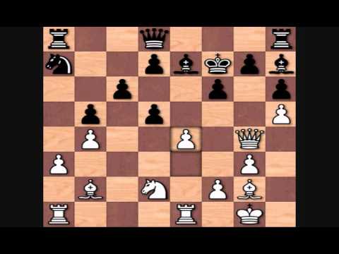 Garry Kasparov vs Ulf Andersson, 1981 Tilburg